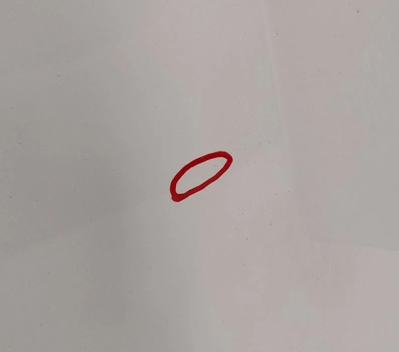 Cofano anteriore Cofano anteriore