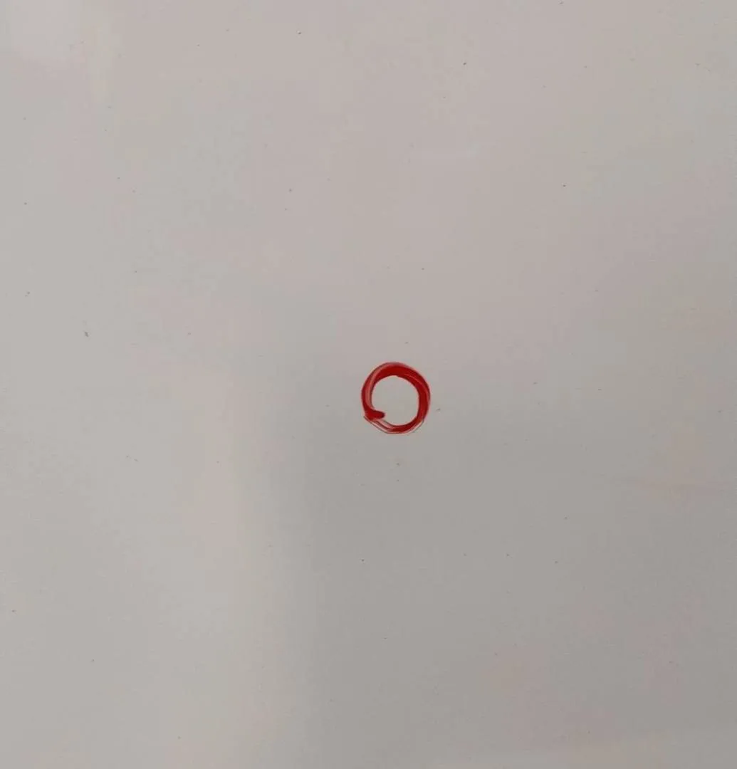 Cofano anteriore Cofano anteriore